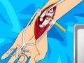 leikur Arm surgery 2