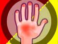 leikur Hands Attack