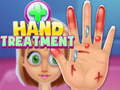 leikur Hand Treatment