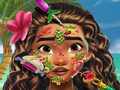 leikur Moana Skin Doctor
