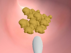 leikur Earwax Clinic